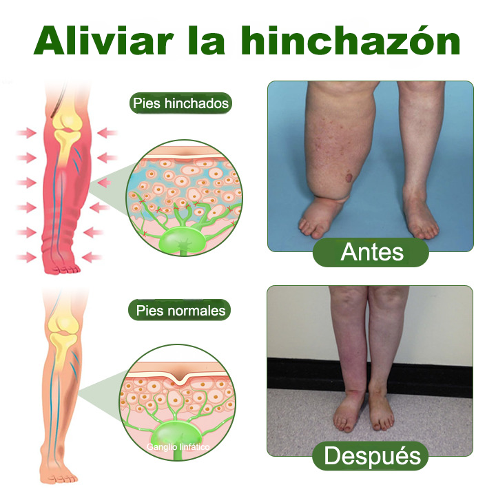 Crema profesional PURELORA® para la circulación de las piernas
