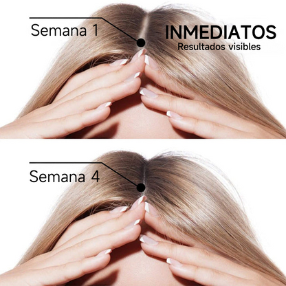 🌿👨‍⚕️ Tienda oficial en EE. UU. 🇺🇸 | 🔥 Champú y acondicionador 2 en 1 PURELORA® de cebolla y romero con complejo activo 15X para el crecimiento capilar: para un cabello con apariencia más gruesa, abundante y fuerte.
