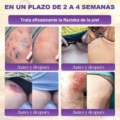 Fabricado y enviado desde EE. UU. 🍁 Purelora® Crema Reparadora de la Piel con Biotina 10 en 1 — Último día de oferta: 75% de descuento