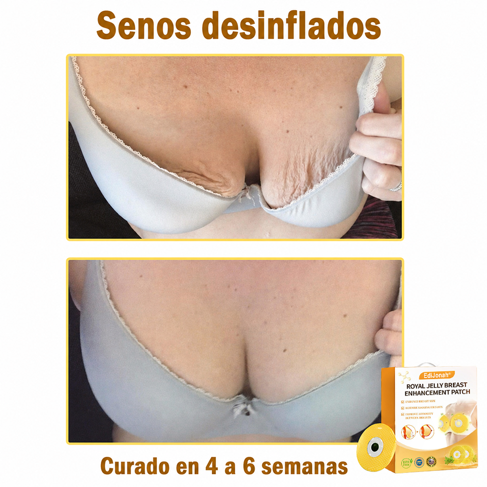 【Tienda Oficial Insignia】𝙀𝙙𝙞𝙟𝙤𝙣𝙖𝙝®🩰 Parche de Aumento de Busto con Jalea Real. Seguro para su uso durante la lactancia.