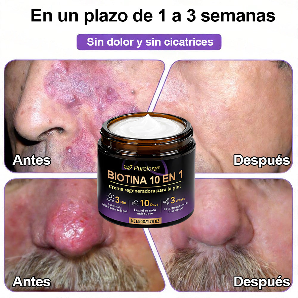 Fabricado y enviado desde EE. UU. 🍁 Purelora® Crema Reparadora de la Piel con Biotina 10 en 1 — Último día de oferta: 75% de descuento