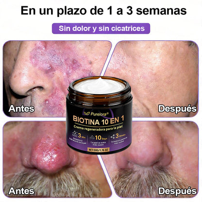 Fabricado y enviado desde EE. UU. 🍁 Purelora® Crema Reparadora de la Piel con Biotina 10 en 1 — Último día de oferta: 75% de descuento