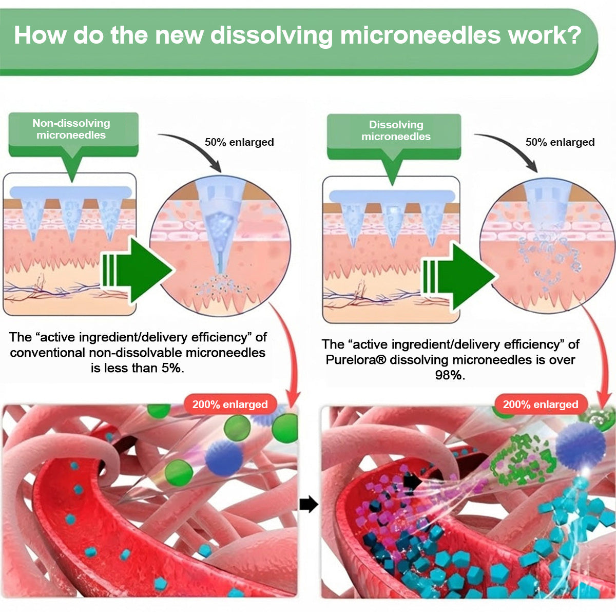 🔥 Nuevo lanzamiento | Purelora® Parche 10 en 1 con Nanomicroneedles: Berberina, Vinagre de Sidra de Manzana y EGCG — Quema grasa rebelde • Atenúa las arrugas • Favorece el confort articular (Resultados visibles en solo 7 días)