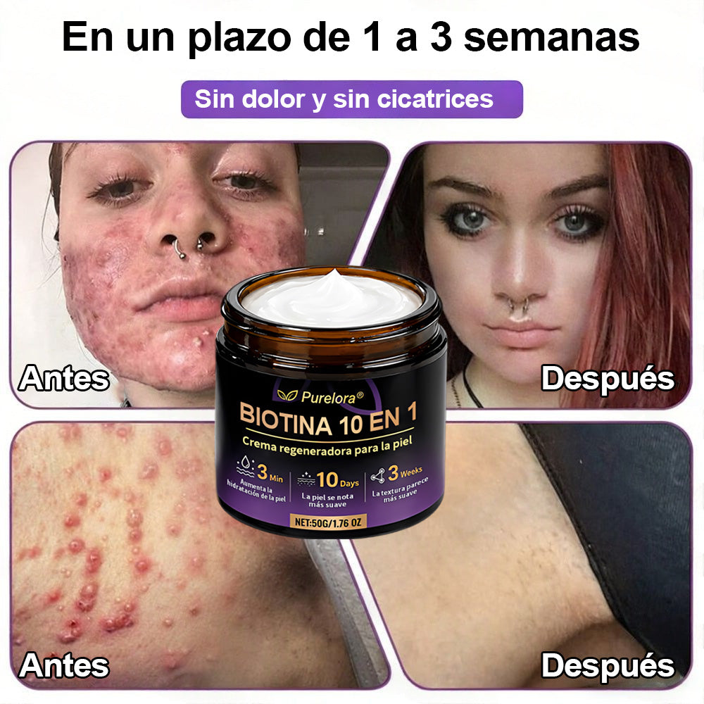 Fabricado y enviado desde EE. UU. 🍁 Purelora® Crema Reparadora de la Piel con Biotina 10 en 1 — Último día de oferta: 75% de descuento