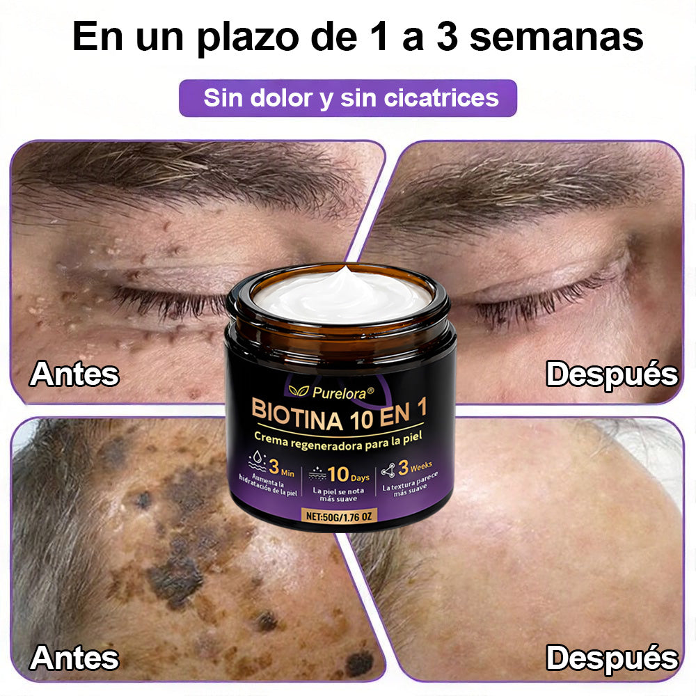 Fabricado y enviado desde EE. UU. 🍁 Purelora® Crema Reparadora de la Piel con Biotina 10 en 1 — Último día de oferta: 75% de descuento