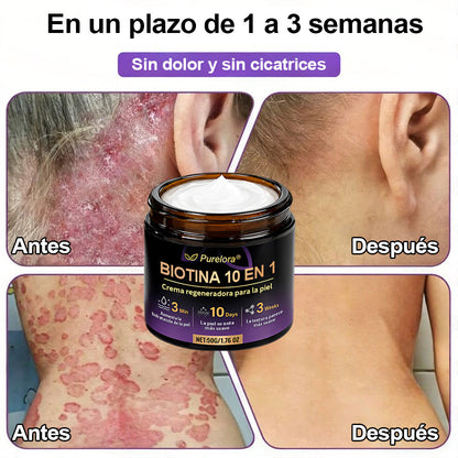 Fabricado y enviado desde EE. UU. 🍁 Purelora® Crema Reparadora de la Piel con Biotina 10 en 1 — Último día de oferta: 75% de descuento