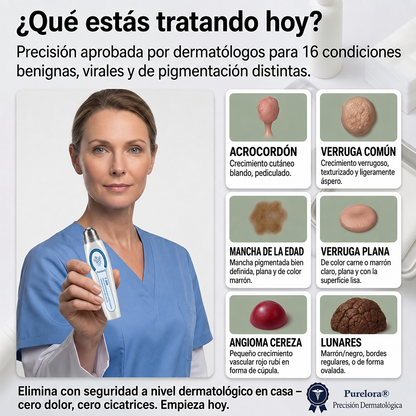 Tienda oficial de la marca | ✅💎 Purelora® Borrador de verrugas y manchas de 7 días (Aplicador roll-on: sin dolor ni cicatrices)
