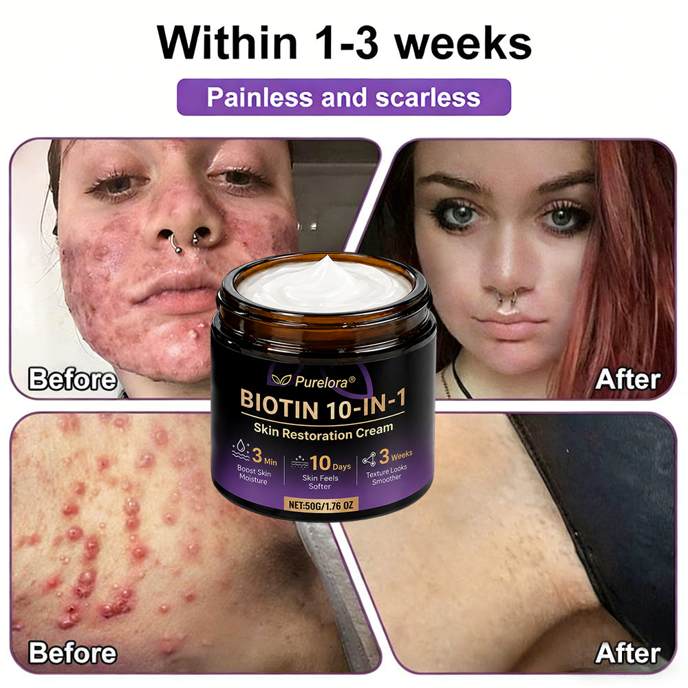 Made and Shipped from the USA 🍁 Purelora® Biotin 10-in-1 Skin Repair Cream — Last Day of Sale: 75% Off
