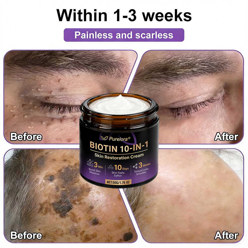 Made and Shipped from the USA 🍁 Purelora® Biotin 10-in-1 Skin Repair Cream — Last Day of Sale: 75% Off