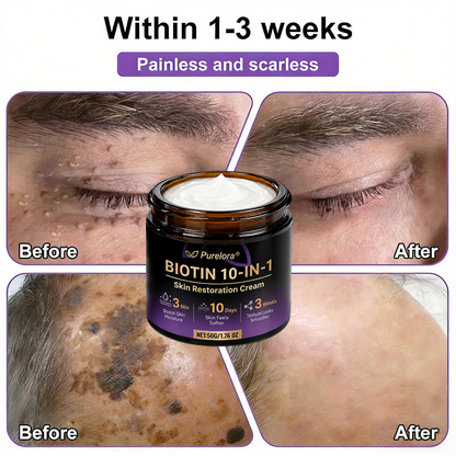 Made and Shipped from the USA 🍁 Purelora® Biotin 10-in-1 Skin Repair Cream — Last Day of Sale: 75% Off