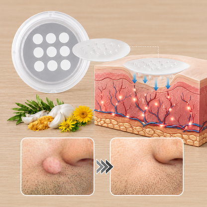 ✨Curalona® 2-in-1 Microneedle and Hydrocolloid Patch🍀 | Removes raised moles, acne, flat warts, and skin fibromas | Helps improve wrinkles, scars, and imperfections | Invisible patches for face and body