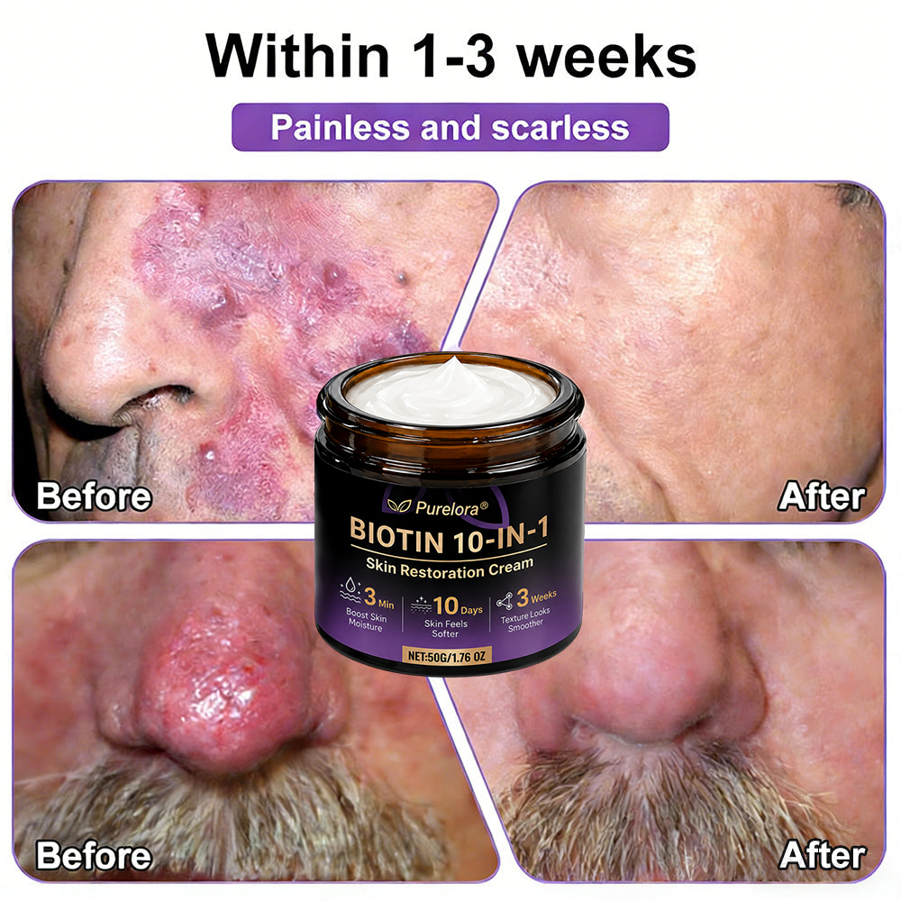 Made and Shipped from the USA 🍁 Purelora® Biotin 10-in-1 Skin Repair Cream — Last Day of Sale: 75% Off