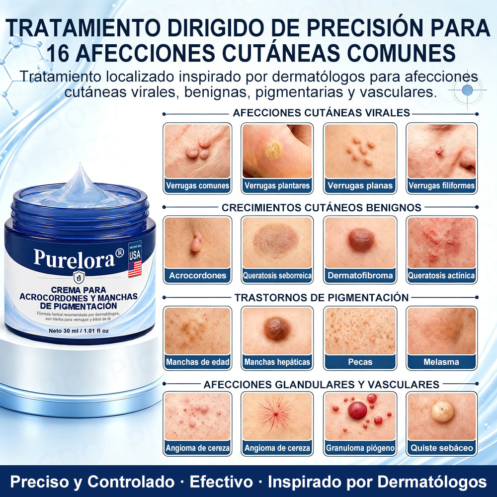 Crema PURELORA® para eliminar verrugas cutáneas e imperfecciones en 7 días (fórmula indolora, sin cicatrices) 🌹🌹