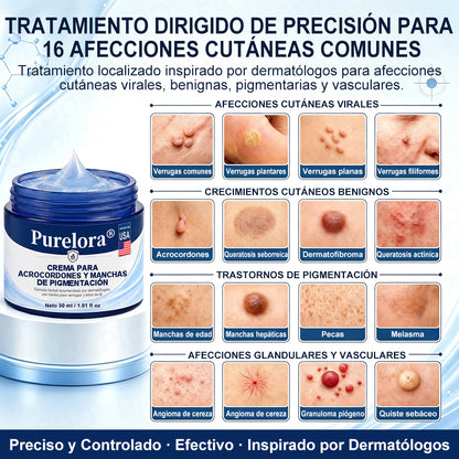 Crema PURELORA® para eliminar verrugas cutáneas e imperfecciones en 7 días (fórmula indolora, sin cicatrices) 🌹🌹