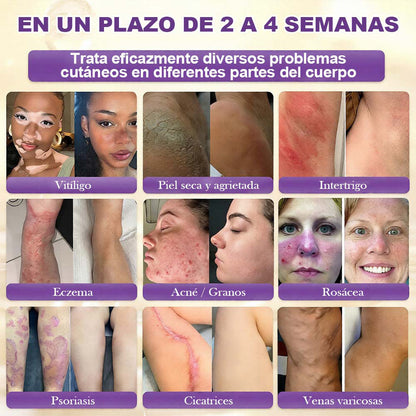 Fabricado y enviado desde EE. UU. 🍁 Purelora® Crema Reparadora de la Piel con Biotina 10 en 1 — Último día de oferta: 75% de descuento